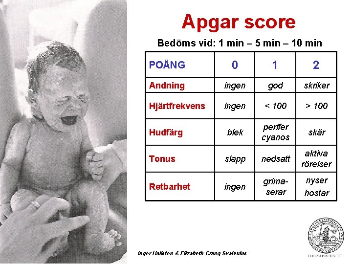 Apgar score Bedöms vid: 1 min – 5 min – 10 min POÄNG 0