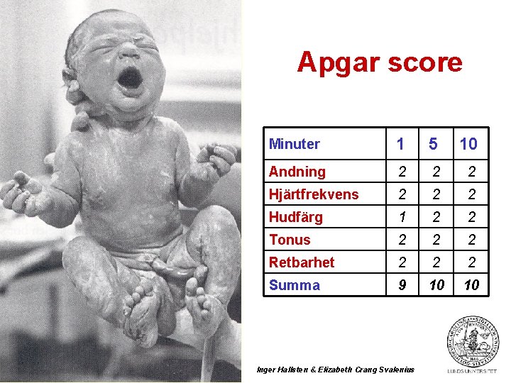 Apgar score Minuter 1 5 10 Andning 2 2 2 Hjärtfrekvens 2 2 2