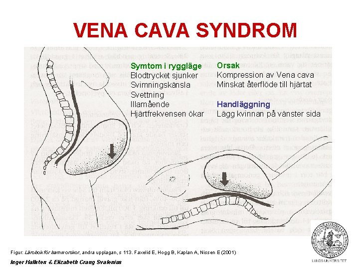 VENA CAVA SYNDROM Symtom i ryggläge Blodtrycket sjunker Svimningskänsla Svettning Illamående Hjärtfrekvensen ökar Orsak