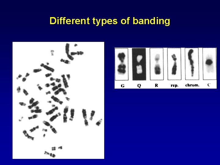 Different types of banding 