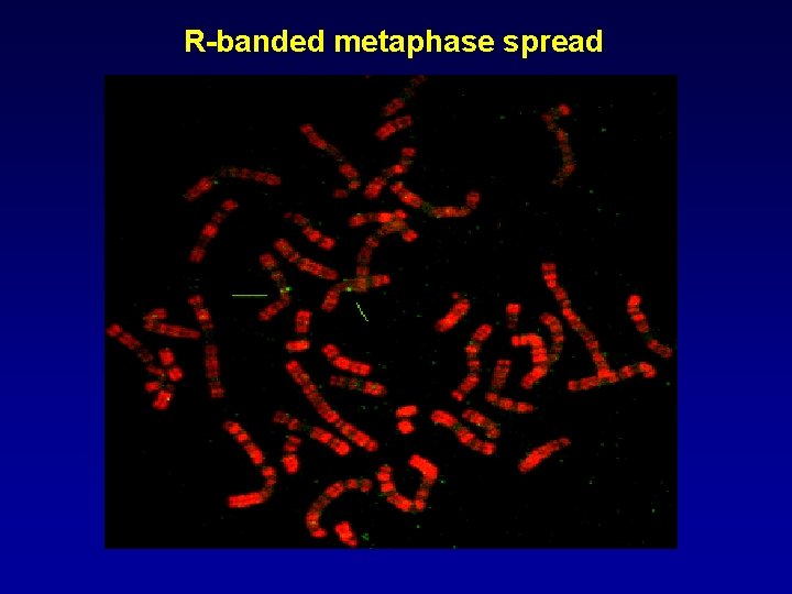 R-banded metaphase spread 