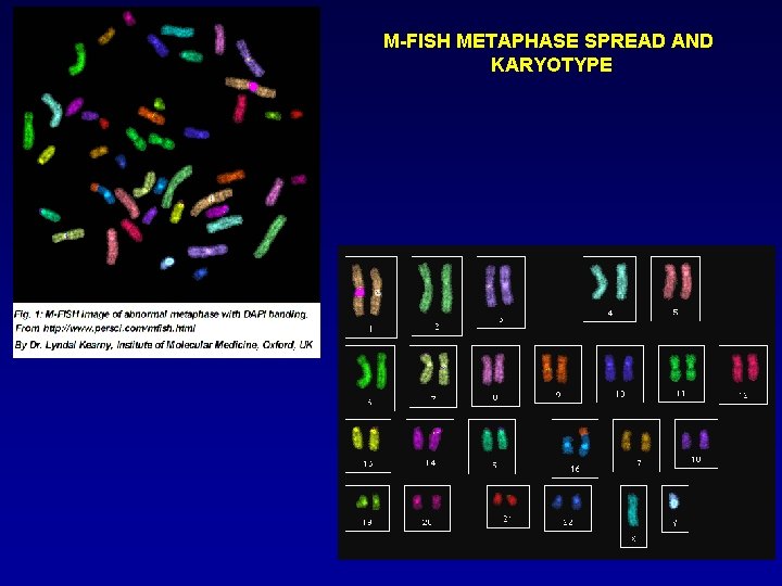 M-FISH METAPHASE SPREAD AND KARYOTYPE 