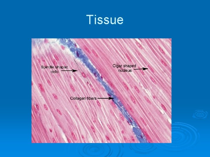 Tissue 