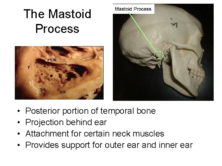 The Mastoid Process • • Posterior portion of temporal bone Projection behind ear Attachment