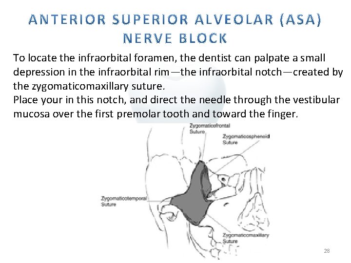 To locate the infraorbital foramen, the dentist can palpate a small depression in the