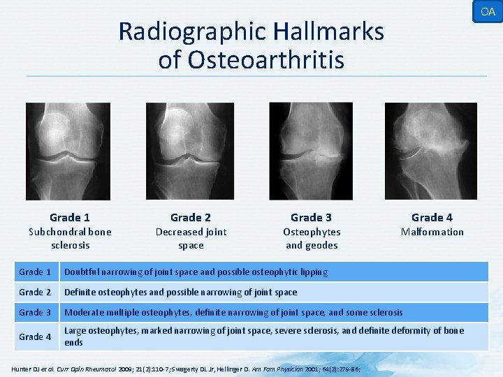 osteoarthritis radiology grading)