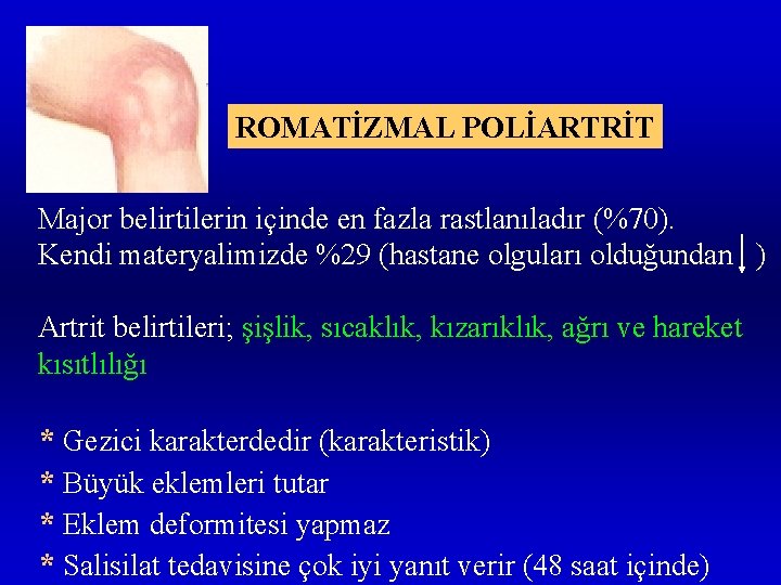 ROMATİZMAL POLİARTRİT Major belirtilerin içinde en fazla rastlanıladır (%70). Kendi materyalimizde %29 (hastane olguları