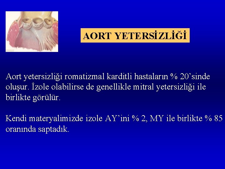 AORT YETERSİZLİĞİ Aort yetersizliği romatizmal karditli hastaların % 20’sinde oluşur. İzole olabilirse de genellikle