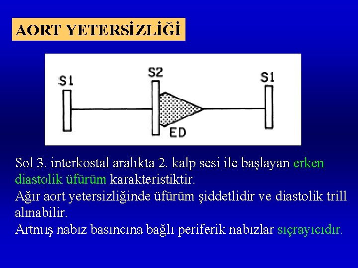 AORT YETERSİZLİĞİ Sol 3. interkostal aralıkta 2. kalp sesi ile başlayan erken diastolik üfürüm
