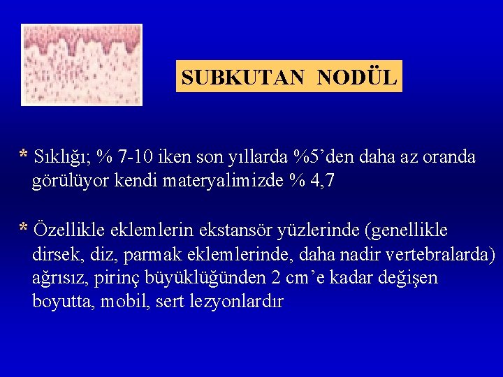 SUBKUTAN NODÜL * Sıklığı; % 7 -10 iken son yıllarda %5’den daha az oranda