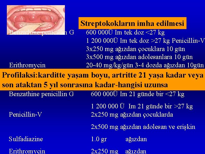 Streptokokların imha edilmesi Benzathine penicillin G Erithromycin 600 000Ü Im tek doz <27 kg