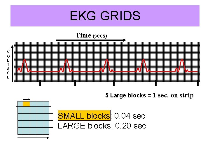 EKG GRIDS Time (secs) V O L T A G E 5 Large blocks