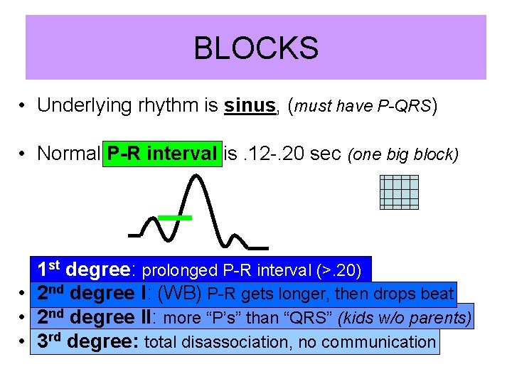 BLOCKS • Underlying rhythm is sinus, (must have P-QRS) • Normal P-R interval is.