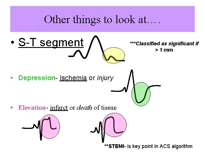 Other things to look at…. • S-T segment ***Classified as significant if > 1