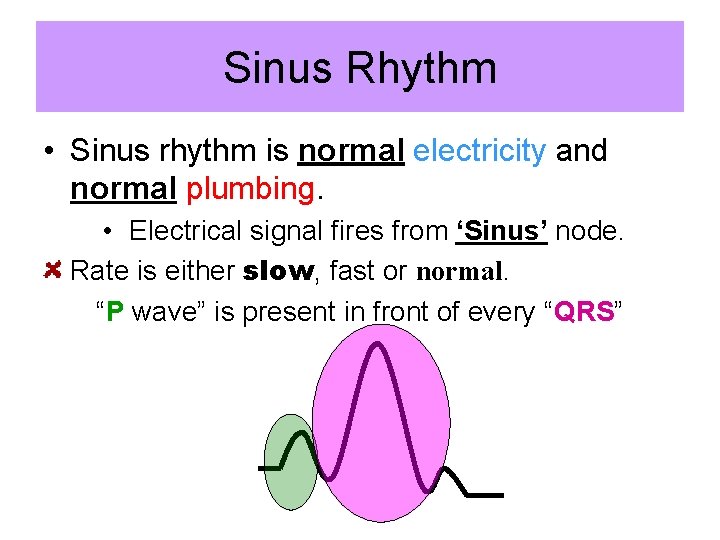 Sinus Rhythm • Sinus rhythm is normal electricity and normal plumbing. • Electrical signal