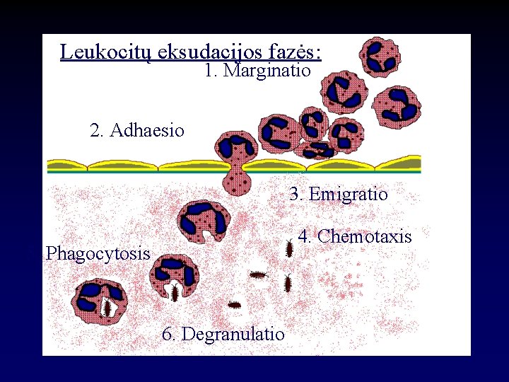 Leukocitų eksudacijos fazės: 1. Marginatio 2. Adhaesio 3. Emigratio 4. Chemotaxis 5. Phagocytosis 6.
