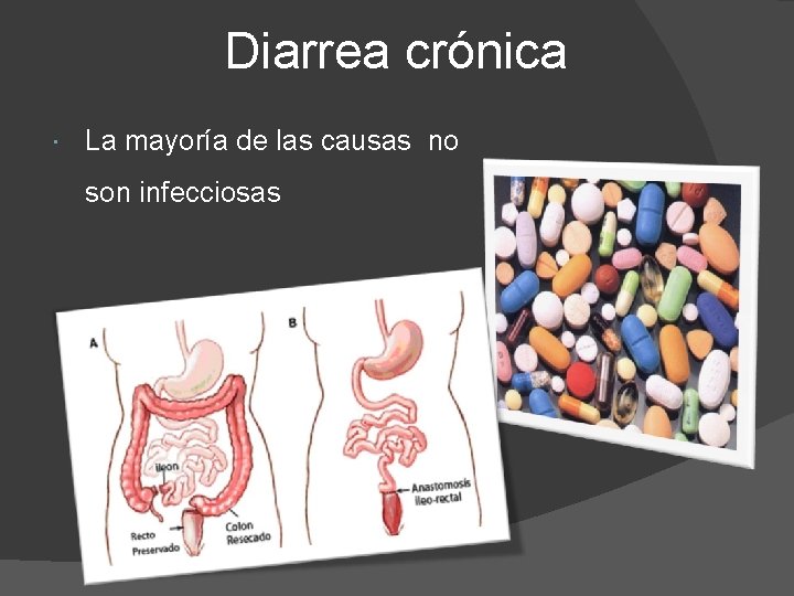 Diarrea crónica La mayoría de las causas no son infecciosas 