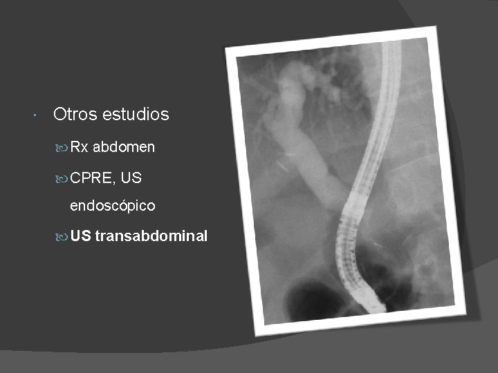  Otros estudios Rx abdomen CPRE, US endoscópico US transabdominal 
