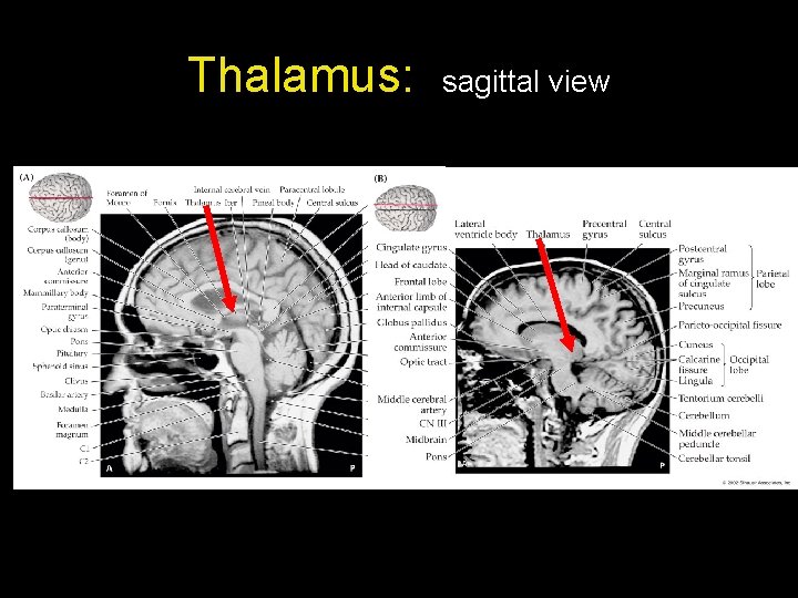 Thalamus: sagittal view Thalamus: sagittal view
