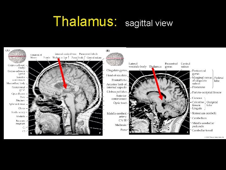 Thalamus: sagittal view 