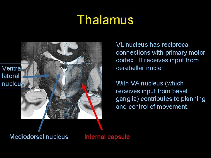 Thalamus Ventral lateral nucleus Mediodorsal nucleus VL nucleus has reciprocal connections with primary motor Thalamus Ventral lateral nucleus Mediodorsal nucleus VL nucleus has reciprocal connections with primary motor