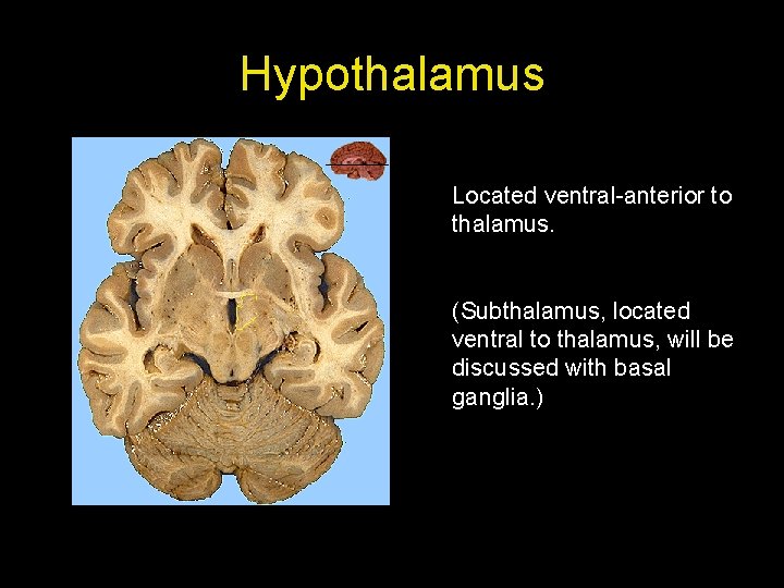 Hypothalamus Located ventral-anterior to thalamus. (Subthalamus, located ventral to thalamus, will be discussed with