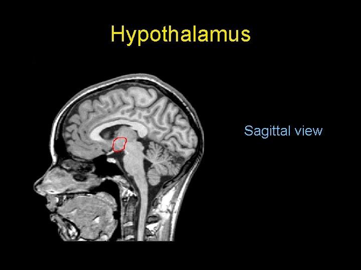 Hypothalamus Sagittal view 