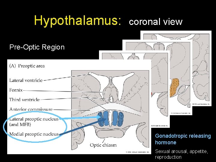Hypothalamus: coronal view Pre-Optic Region Gonadotropic releasing hormone Sexual arousal, appetite, reproduction 