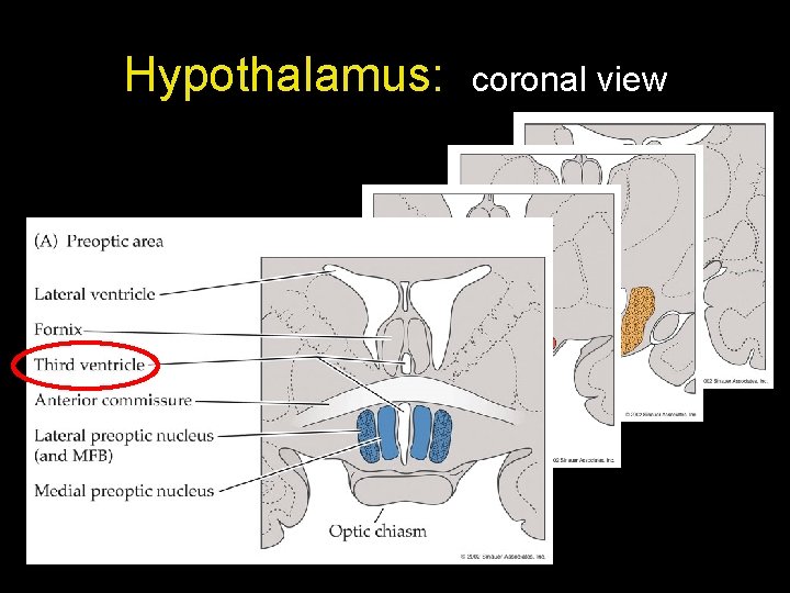 Hypothalamus: coronal view Hypothalamus: coronal view