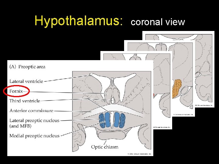 Hypothalamus: coronal view Hypothalamus: coronal view