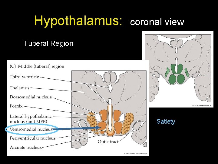 Hypothalamus: coronal view Tuberal Region Satiety 