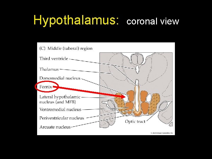Hypothalamus: coronal view Hypothalamus: coronal view