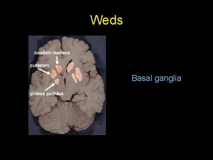 Weds Basal ganglia Weds Basal ganglia
