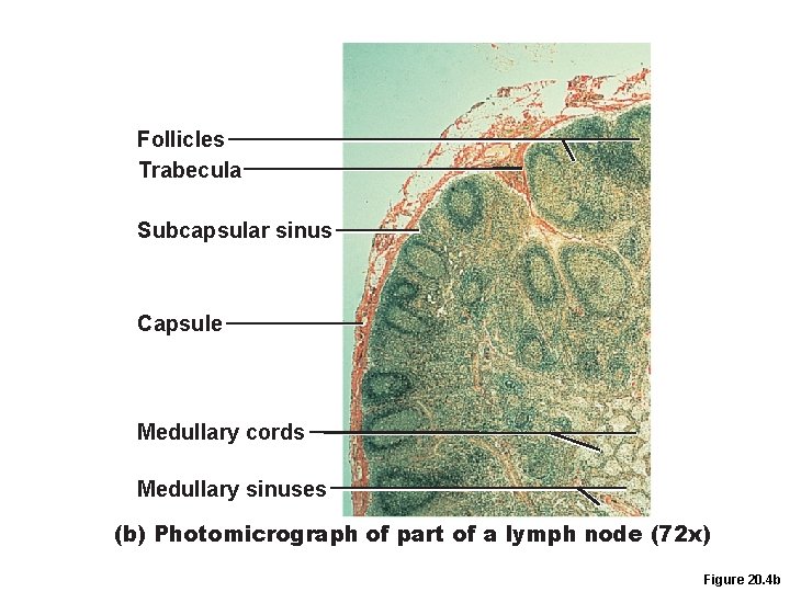 Follicles Trabecula Subcapsular sinus Capsule Medullary cords Medullary sinuses (b) Photomicrograph of part of