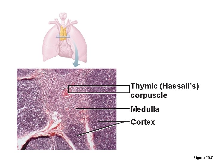 Thymic (Hassall’s) corpuscle Medulla Cortex Figure 20. 7 