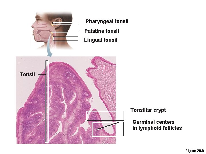 Pharyngeal tonsil Palatine tonsil Lingual tonsil Tonsillar crypt Germinal centers in lymphoid follicles Figure