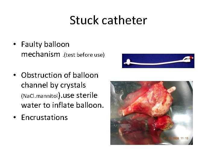 Stuck catheter • Faulty balloon mechanism. (test before use) • Obstruction of balloon channel Stuck catheter • Faulty balloon mechanism. (test before use) • Obstruction of balloon channel