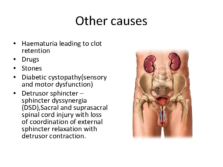 Other causes • Haematuria leading to clot retention • Drugs • Stones • Diabetic Other causes • Haematuria leading to clot retention • Drugs • Stones • Diabetic
