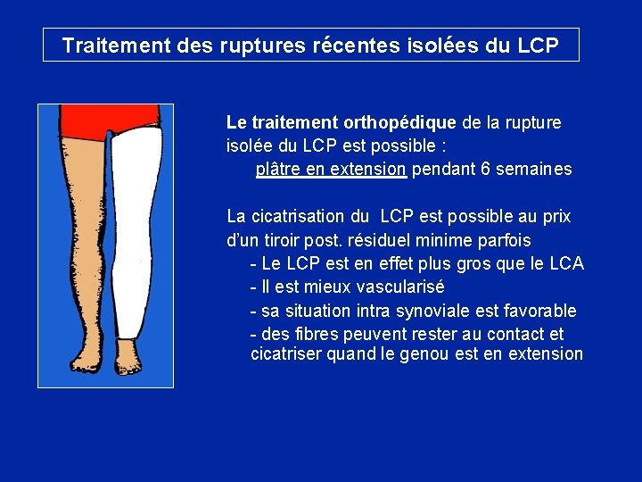 Traitement des ruptures récentes isolées du LCP Le traitement orthopédique de la rupture isolée