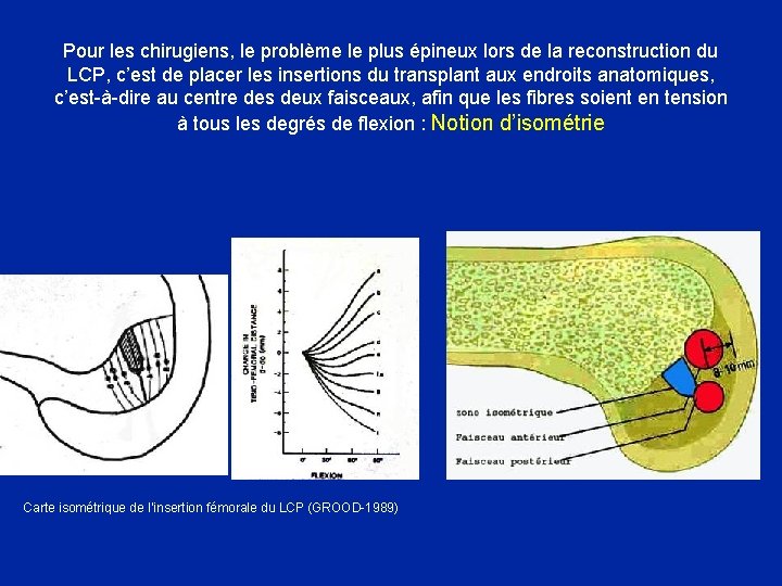 Pour les chirugiens, le problème le plus épineux lors de la reconstruction du LCP,