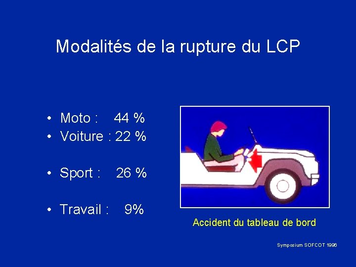 Modalités de la rupture du LCP • Moto : 44 % • Voiture :
