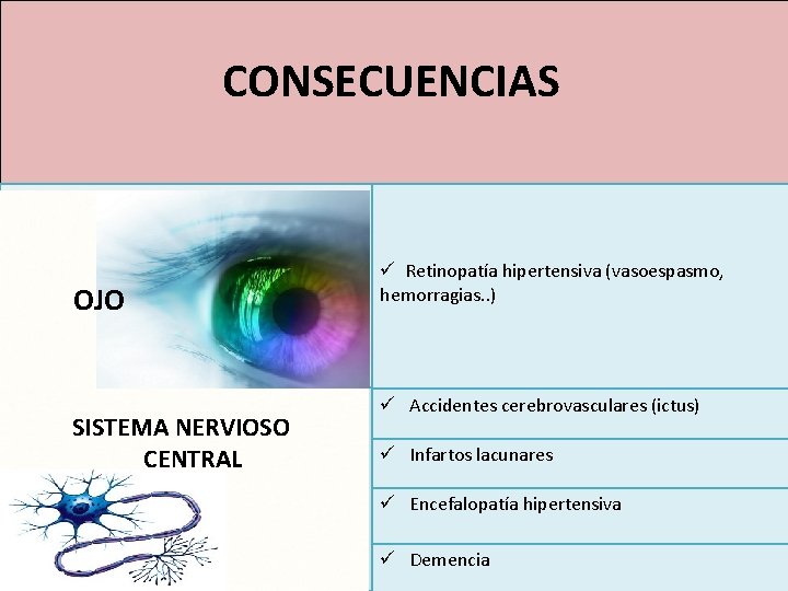 HIPERTENSIÓN ARTERIAL CONSECUENCIAS OJO SISTEMA NERVIOSO CENTRAL ü Retinopatía hipertensiva (vasoespasmo, hemorragias. . )