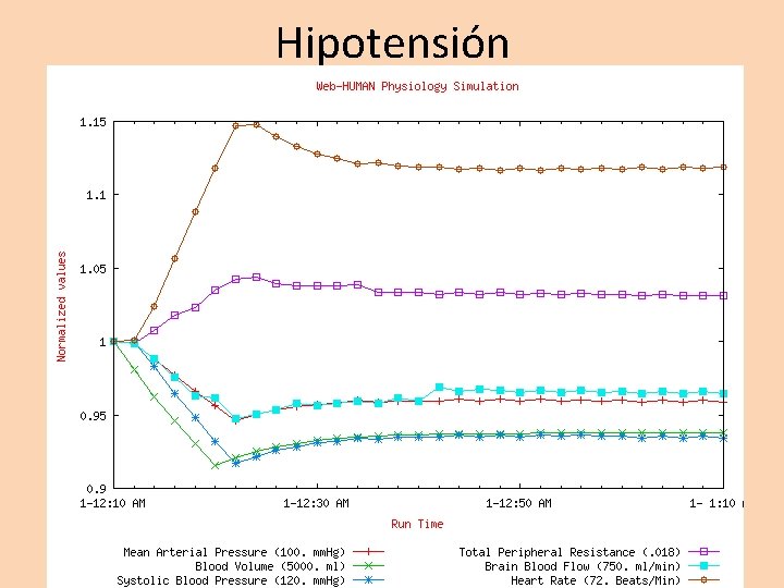 Hipotensión 