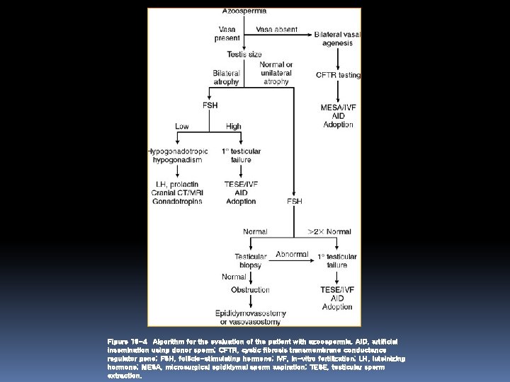 Figure 19 -4 Algorithm for the evaluation of the patient with azoospermia. AID, artificial