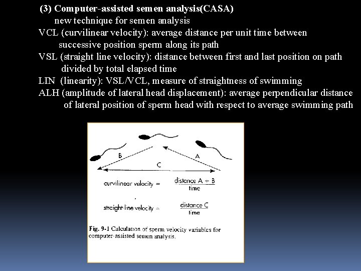 (3) Computer-assisted semen analysis(CASA) new technique for semen analysis VCL (curvilinear velocity): average distance