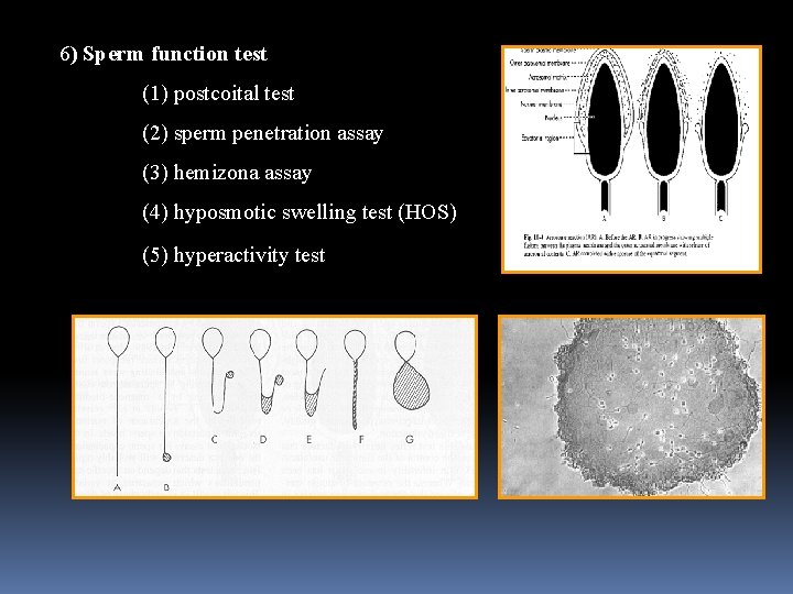  6) Sperm function test (1) postcoital test (2) sperm penetration assay (3) hemizona