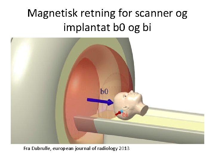 Magnetisk retning for scanner og implantat b 0 og bi Fra Dubrulle, european journal
