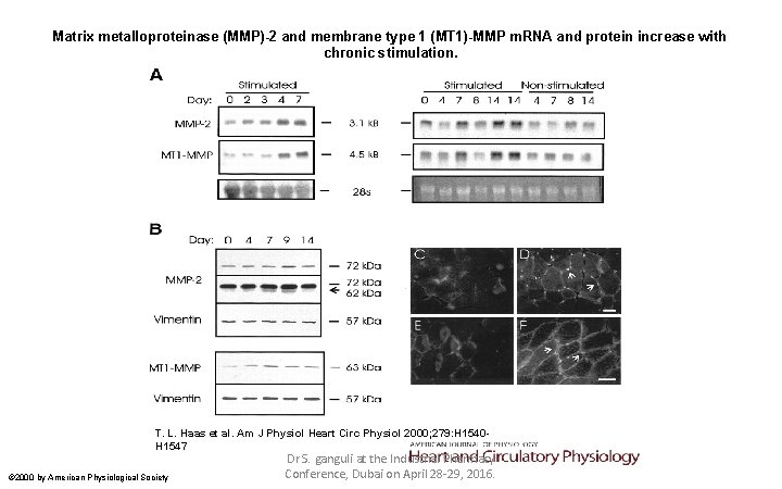 Matrix metalloproteinase (MMP)-2 and membrane type 1 (MT 1)-MMP m. RNA and protein increase