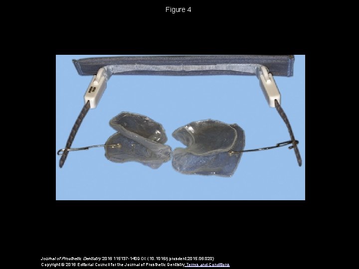 Figure 4 Journal of Prosthetic Dentistry 2016 115137 -140 DOI: (10. 1016/j. prosdent. 2015.