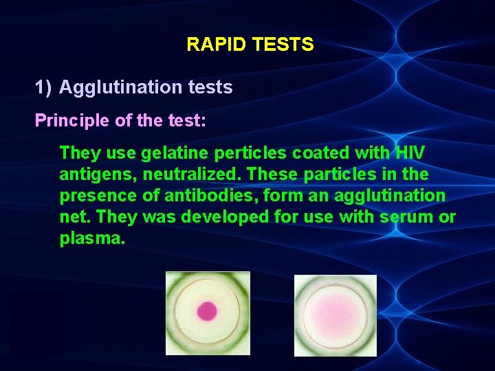 RAPID TESTS 1) Agglutination tests Principle of the test: They use gelatine perticles coated